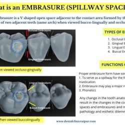 Embrasure space law and ethics