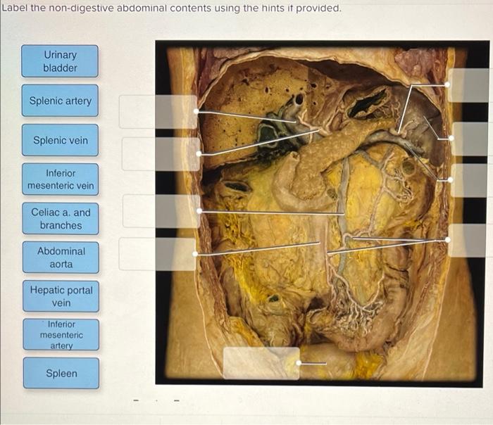 Label the digestive abdominal contents using the hints if provided