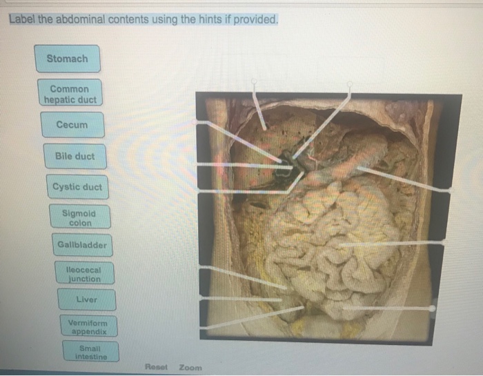 Ct label scan abdominal contents using hints provided solved transcribed problem text been show has