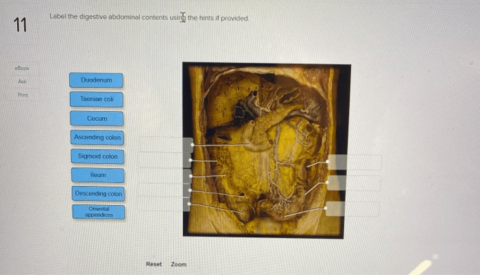 Label the digestive abdominal contents using the hints if provided